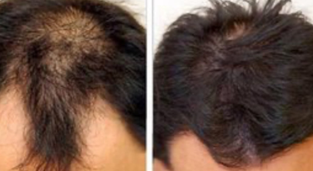 Sanusi Men Organic “Hair & Beard Treatment” 1 oz