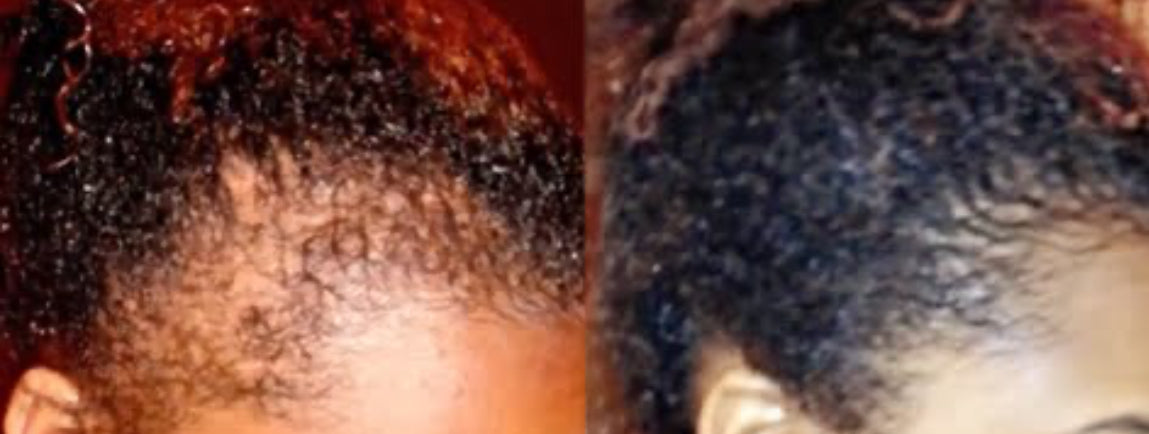 Sanusi Herbal “Hair Treatment" 10 ml