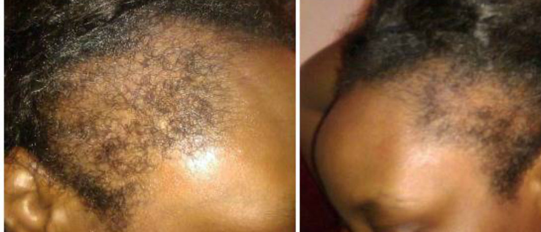 Sanusi Herbal “Hair Treatment" 10 ml